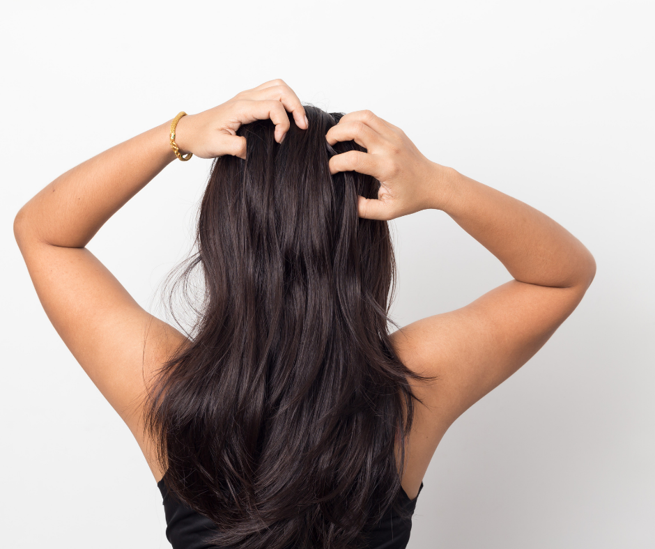 Natural Solutions for Dandruff